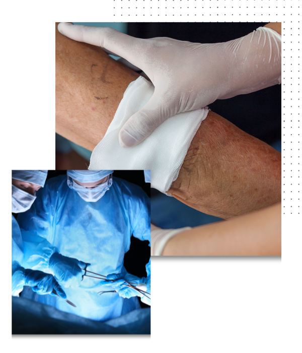 picture of wound care and surgery