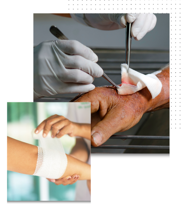 wound care