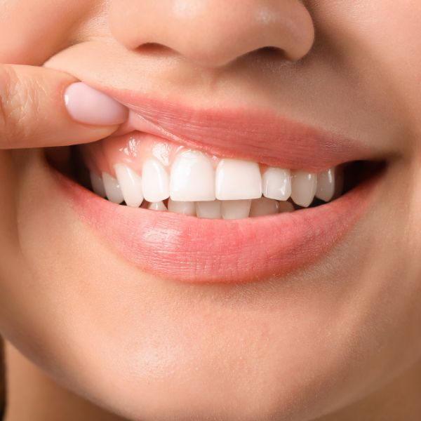 4 Benefits of Regular Dental Cleanings 2.jpg