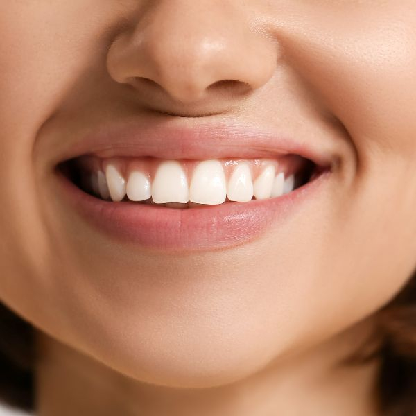 4 Benefits of Regular Dental Cleanings 3.jpg