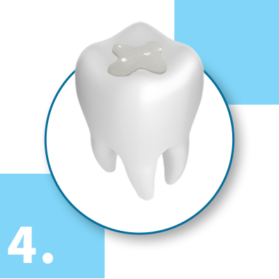 Porcelain Fillings