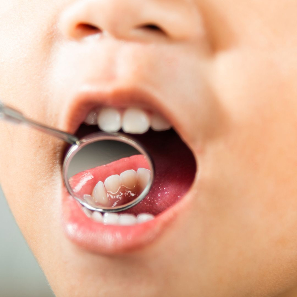 Teaching Kids the Importance of Dental Hygiene 1.jpg