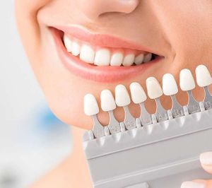 dental-veneers-and-dental-laminates.jpg