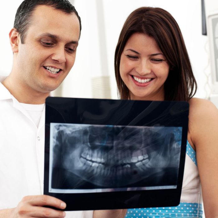 people examining x ray of teeth
