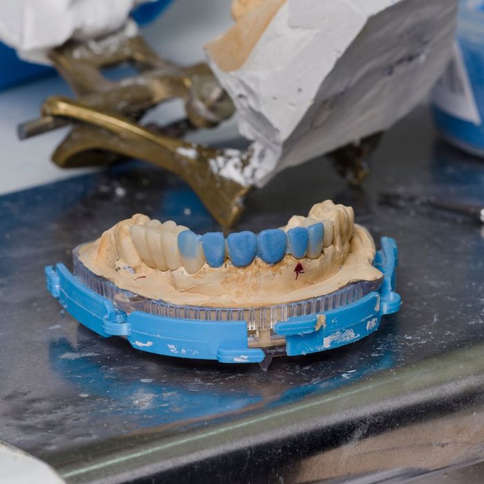 Dentures being created out of an impression. 