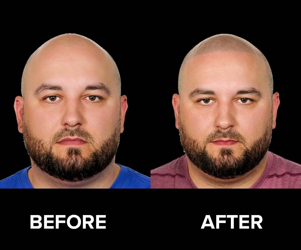 BeforeAfter-17.jpg