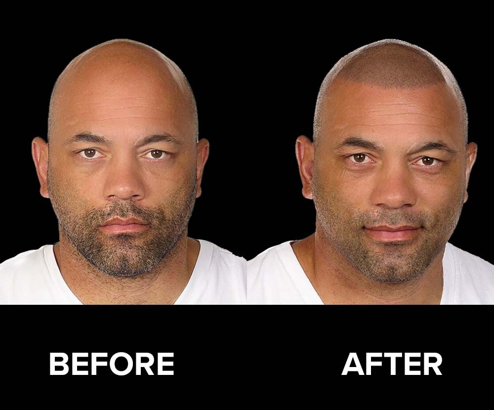 BeforeAfter-10.jpg