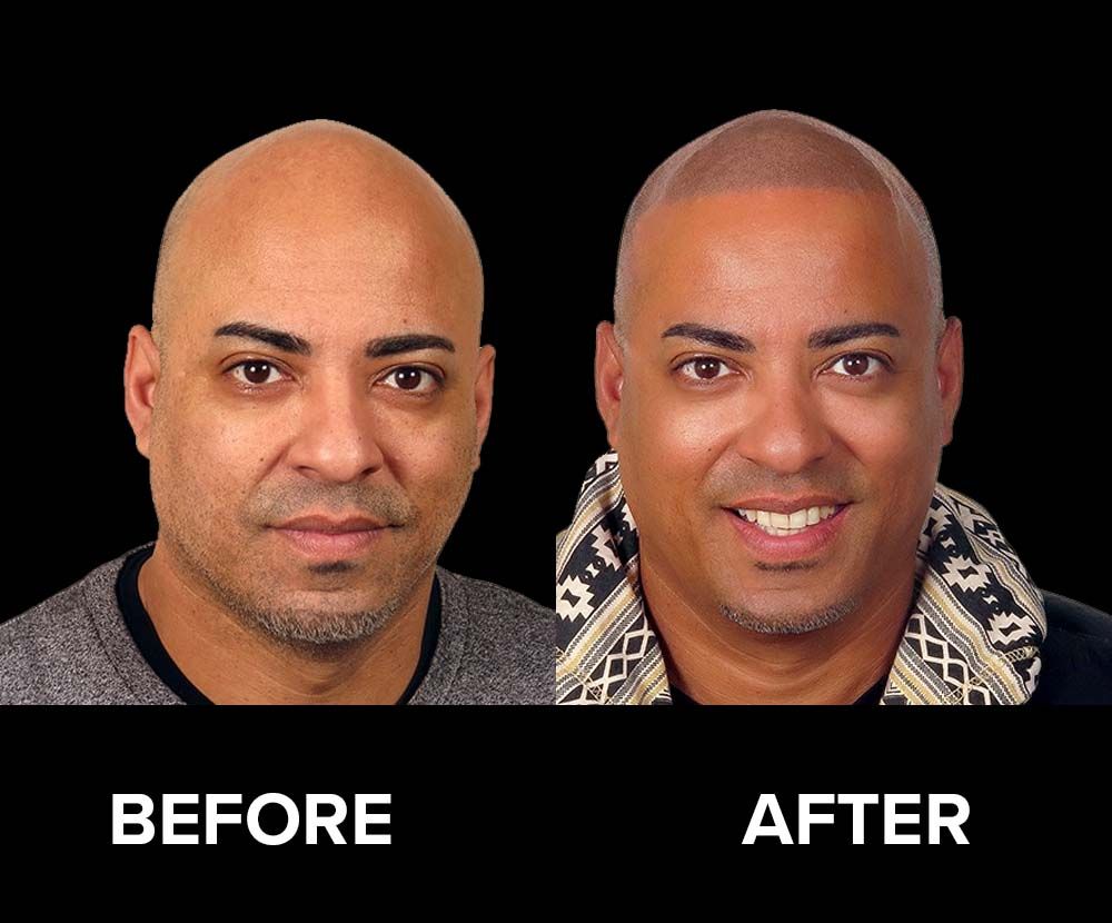 BeforeAfter-01.jpg