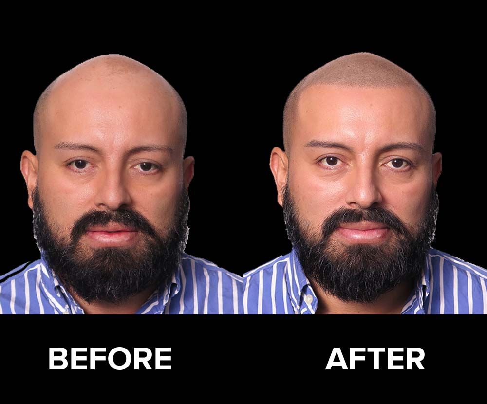 BeforeAfter-14.jpg