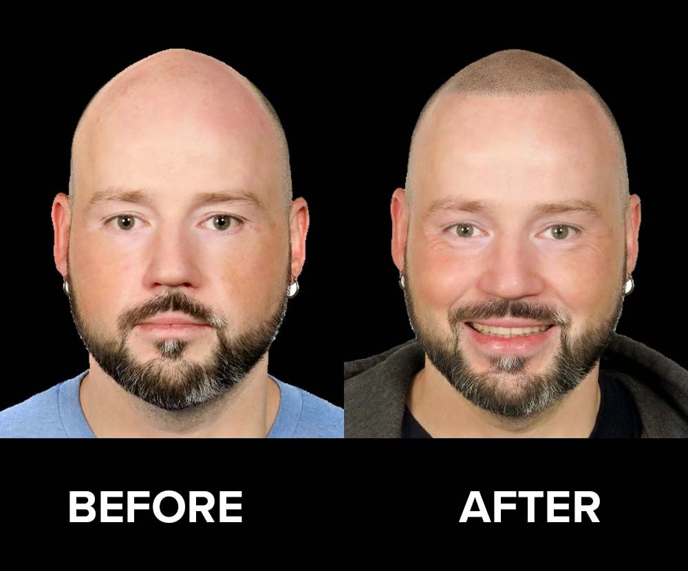 BeforeAfter-11.jpg