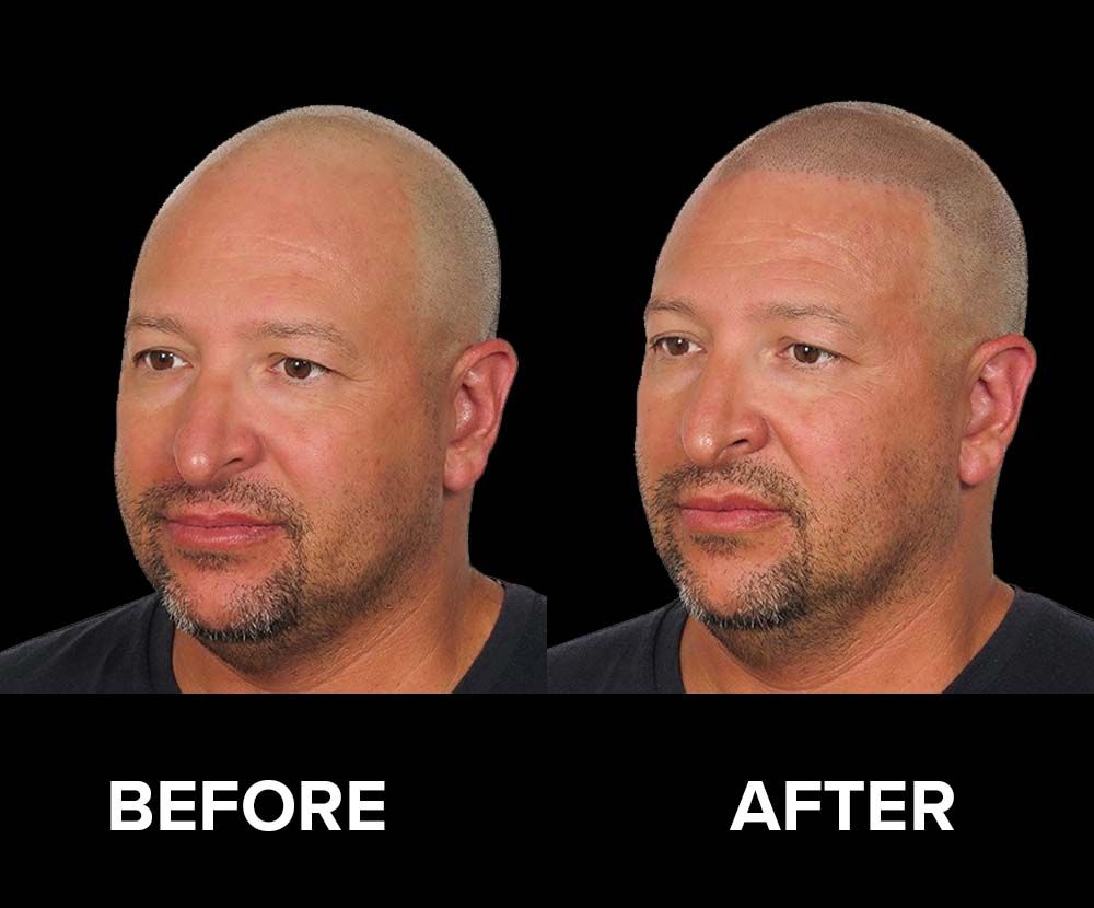 BeforeAfter-12.jpg