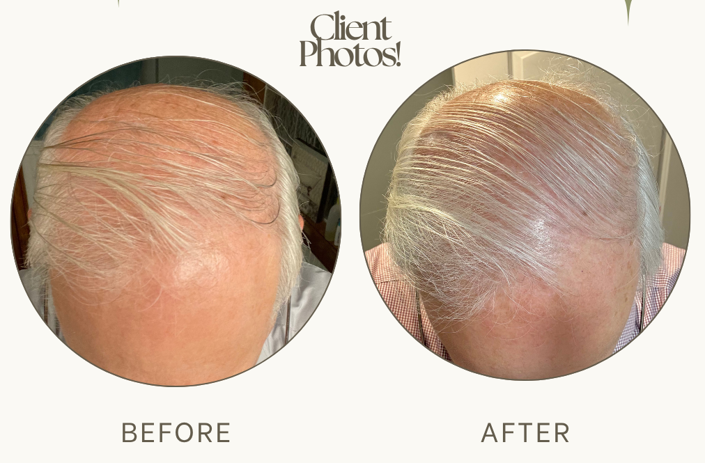Hair REstoration (1).png