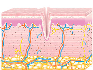 Untreated Skin