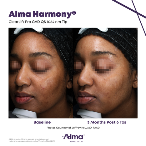 Alma_Harmony_BA_J.Hsu_Q2-24-13436021072-Angle-1_Canva_v2.png