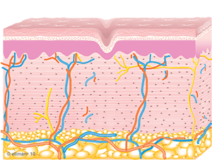 Collagen Remodeling Occurs