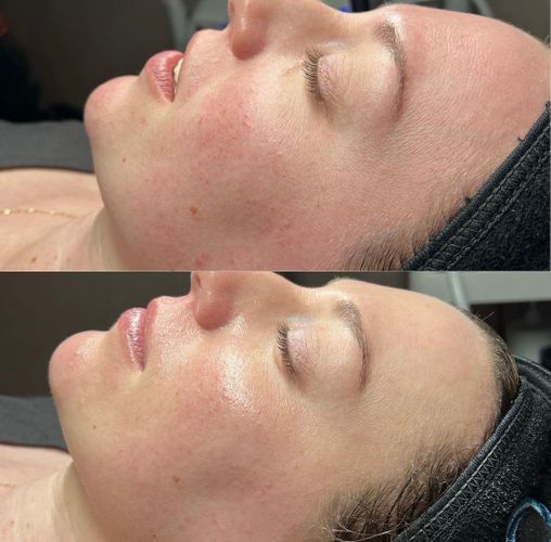 1 Facial (2), GIVE CREDIT TO @skinbychloerose.jpg