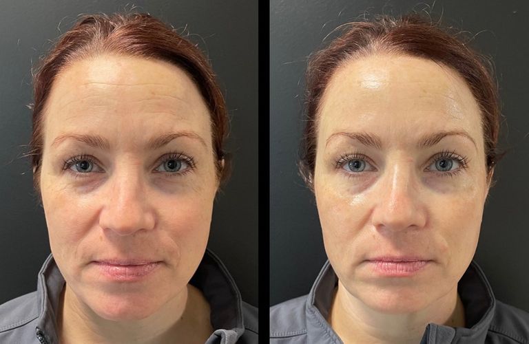 1 Facial, Bare Esthetics.jpeg