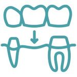 a set of teeth being placed over shaved teeth icon