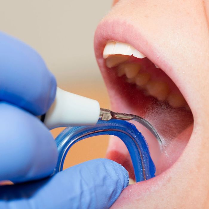 close up of dental cleaning