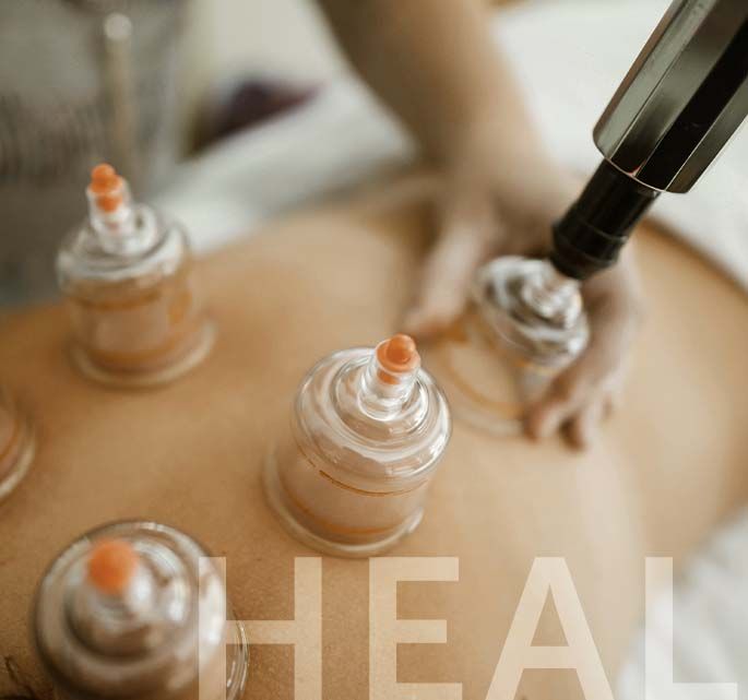 person applying cupping tools to another persons back