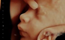 Ultrasound image