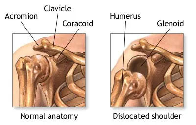 Shoulder bone image