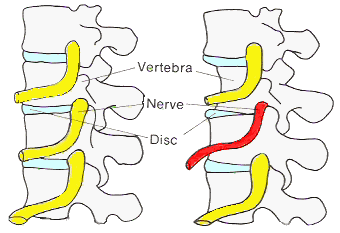 Spine image