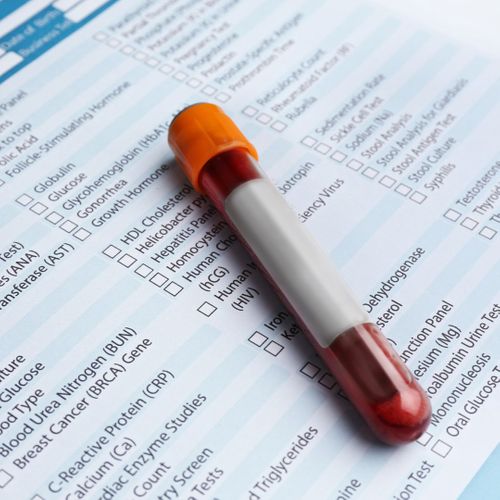 Allergy Identification Through PGx Testing