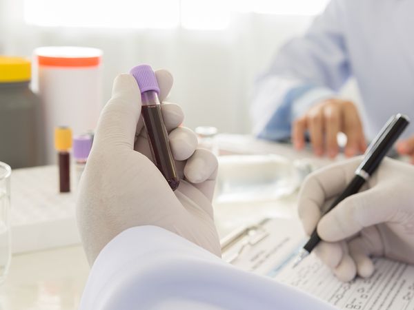 medical personnel examining blood sample medical personnel examining blood sample