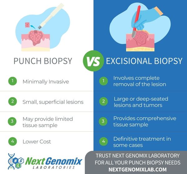 Comparing Punch Biopsy And Excisional Biopsy infographic