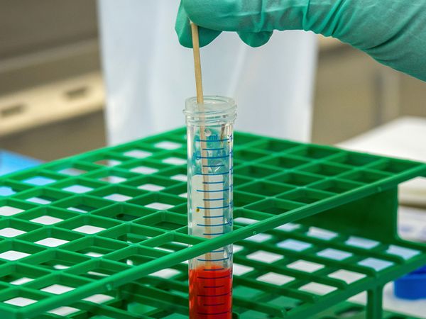 Testing blood for genetic conditions and disorders