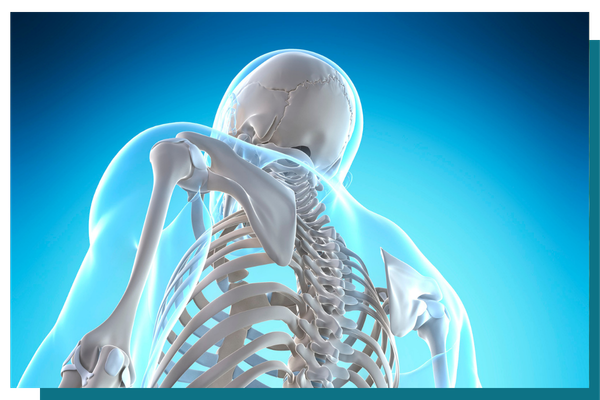 Osteoporosis3.png