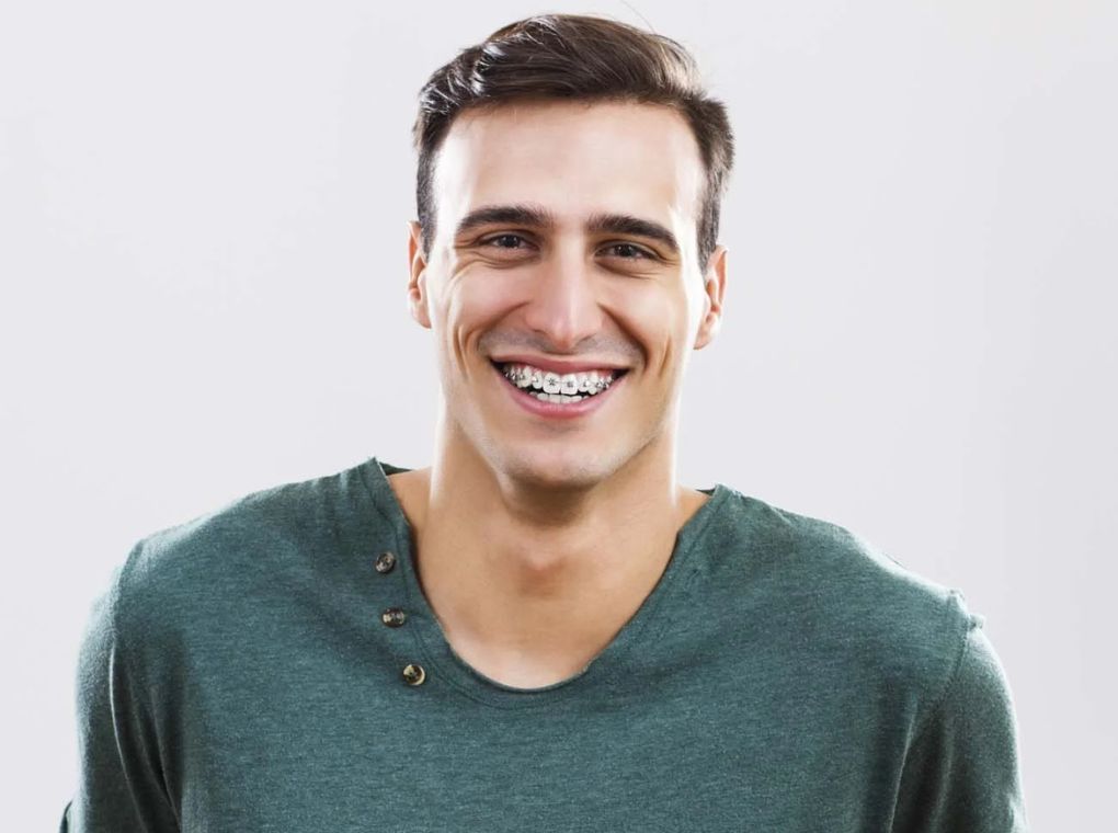 a young man smiling with braces a young man smiling with braces