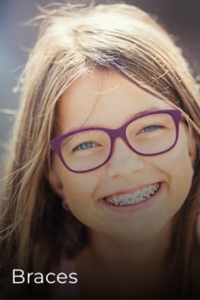 braces-homepage.jpg