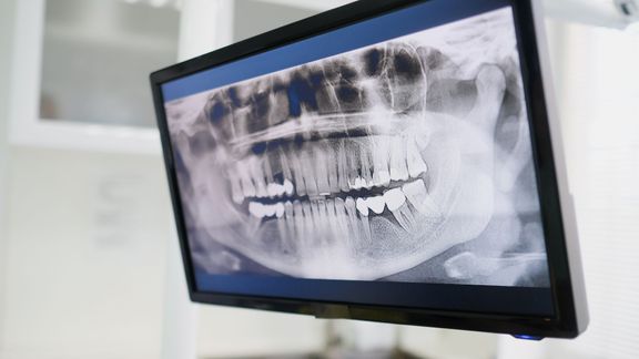 The Role of Technology in Modern Dentistry at Kruckman Family Dentistry.jpg