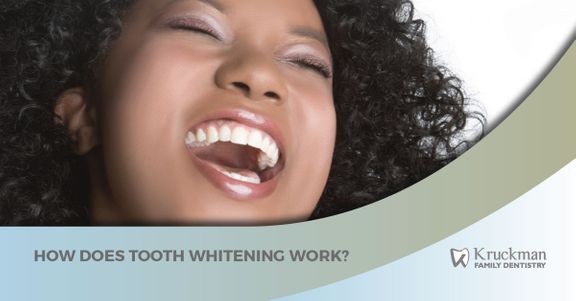 How-Does-Tooth-Whitening-Work-58f90cb84df1d.jpg