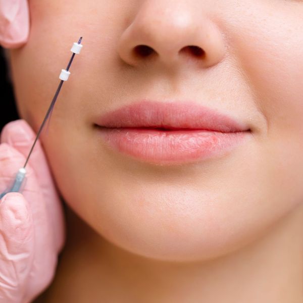 DPO thread being injected into a woman's face. 