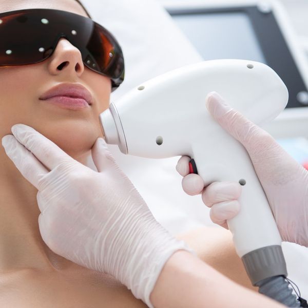 woman receiving laser hair removal treatment on face