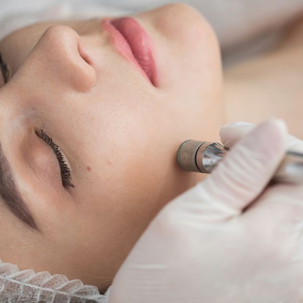 What Does Microdermabrasion Do 1.jpg