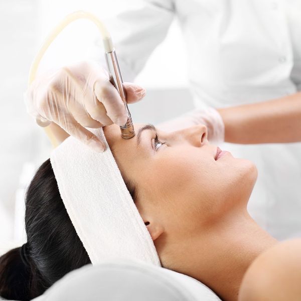 What Does Microdermabrasion Do 2.jpg