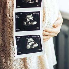 close up of strip of ultrasound images