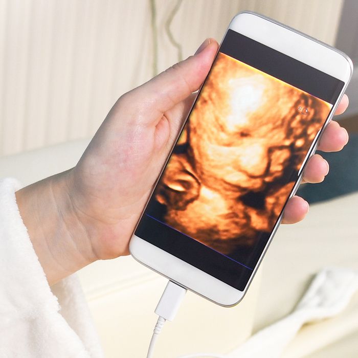 Image of a 3d image of a baby on a woman's cell phone