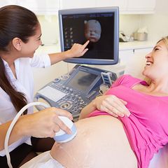 tech pointing to woman's baby on ultrasound