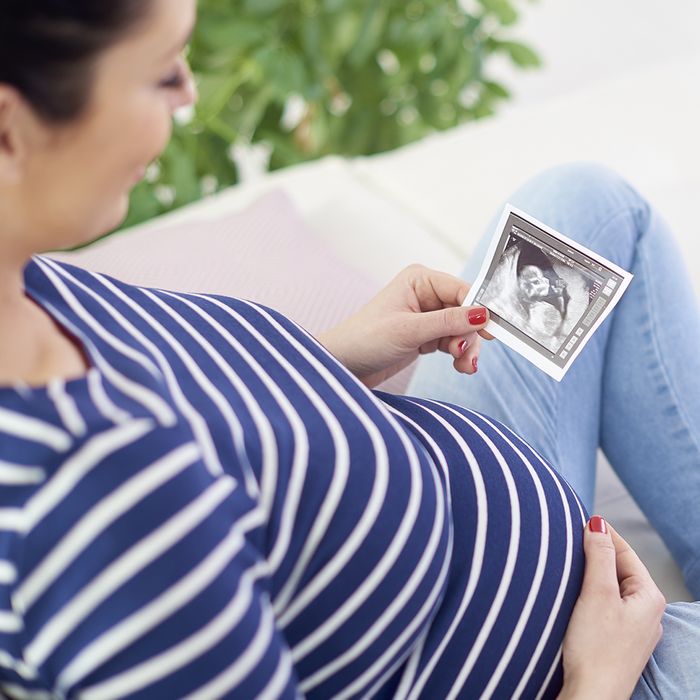 Image of a woman looking at an ultrasound image