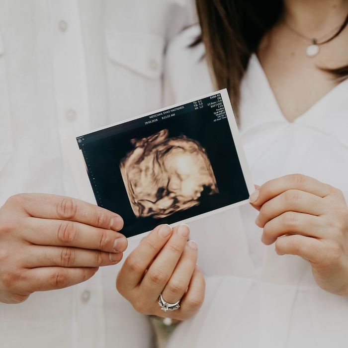 Couple with ultrasound photo