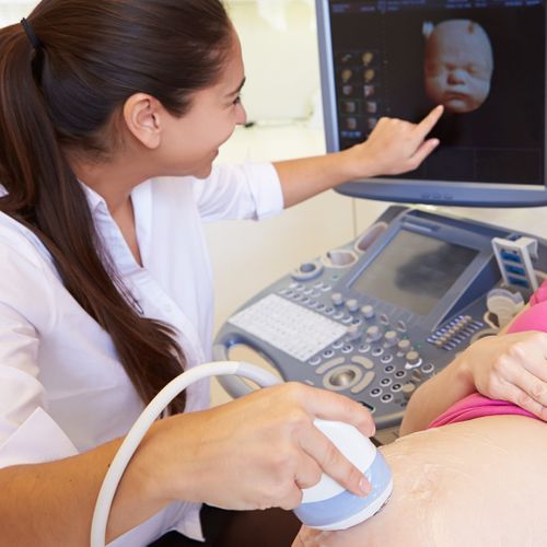 Image of a woman looking at a 3d image from an ultrasound