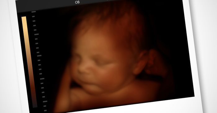 Ultrasound image