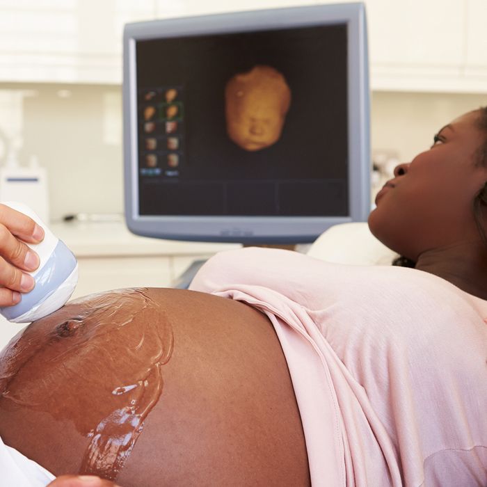 A woman sees her baby on a monitor during an ultrasound