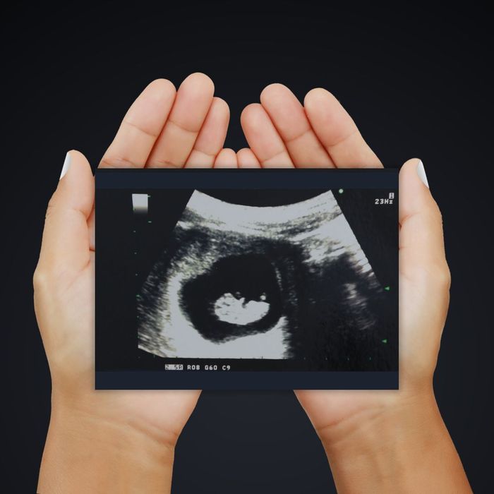 ultrasound image 