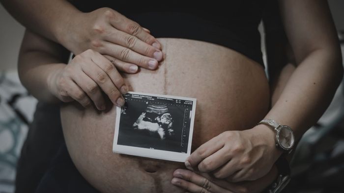 couple holding ultrasound